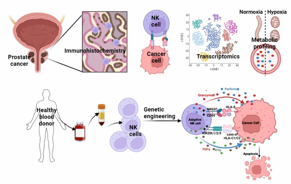 Characterization of Natural Killer cells in Prostate Cancer and Therapeutic Interventions