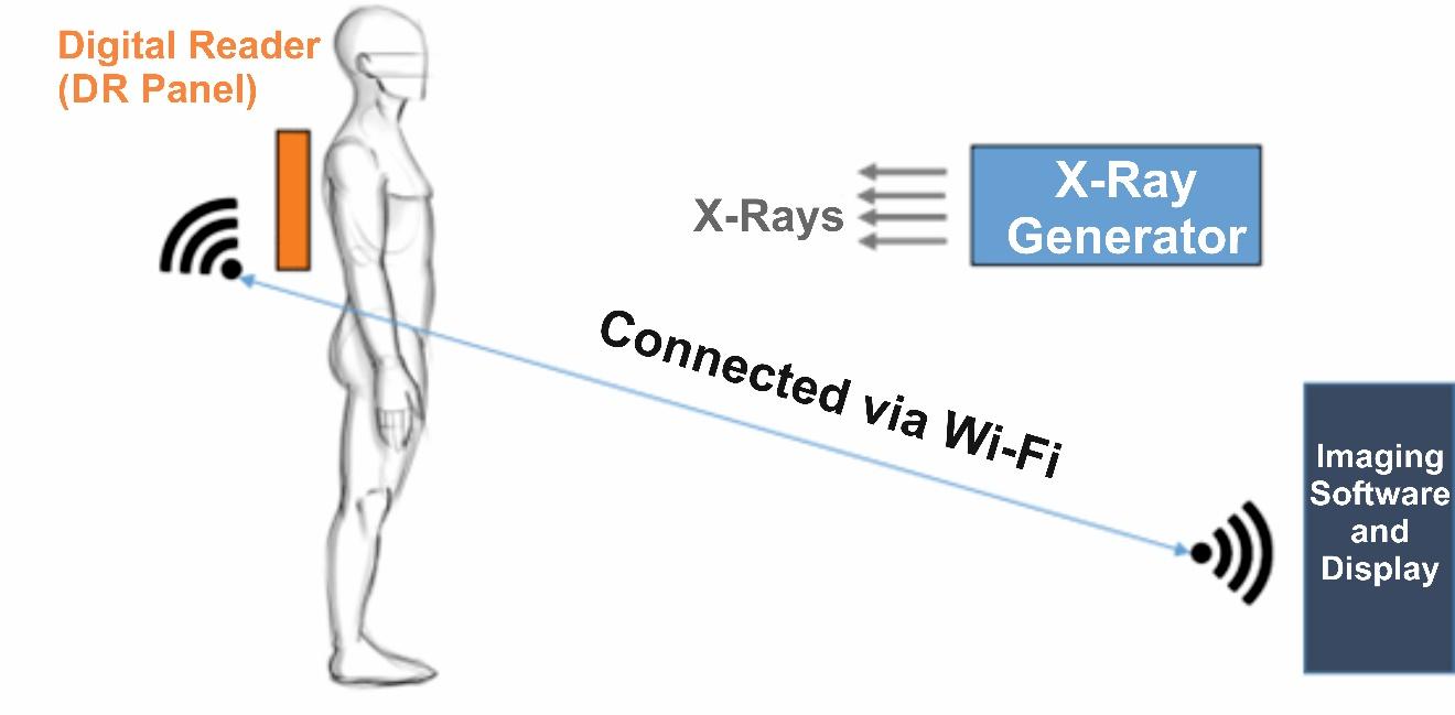 Developing affordable and AI-enabled handheld X-ray device for Tuberculosis Diagnosis